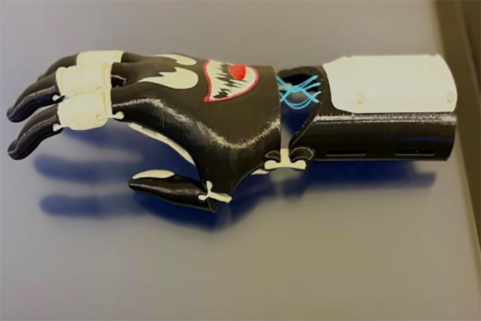 DONAZIONE ARTISTICO MANO ARTIFICIALE 3